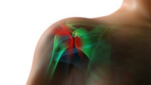 cartilage cause shoulder pain