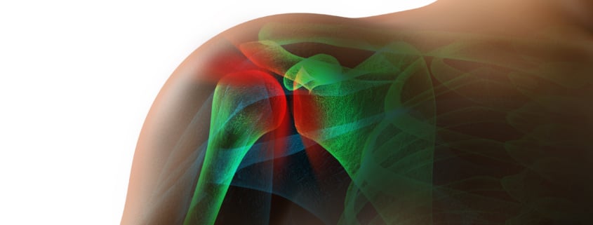 cartilage cause shoulder pain