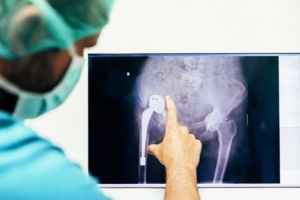 Orthopedic FAQ