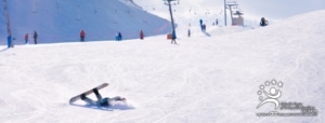 clavicle fracture from ski or snowboard accident