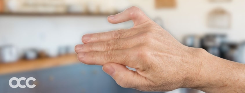 Boutonnière Deformity