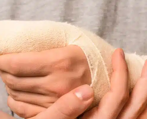 thumb fracture
