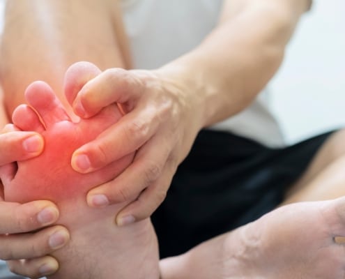 Mortons’ Neuroma