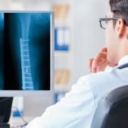 OCC - Colorado Center of Orthopaedic Excellence Femur Fracture