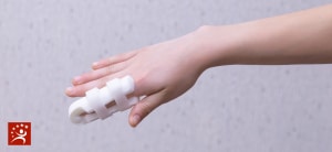 Finger Fracture