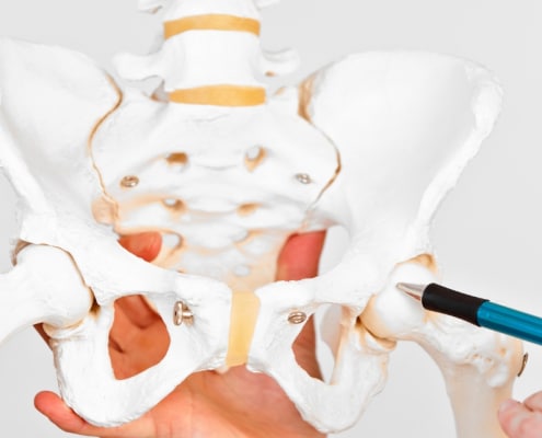 Synovitis of the Hip