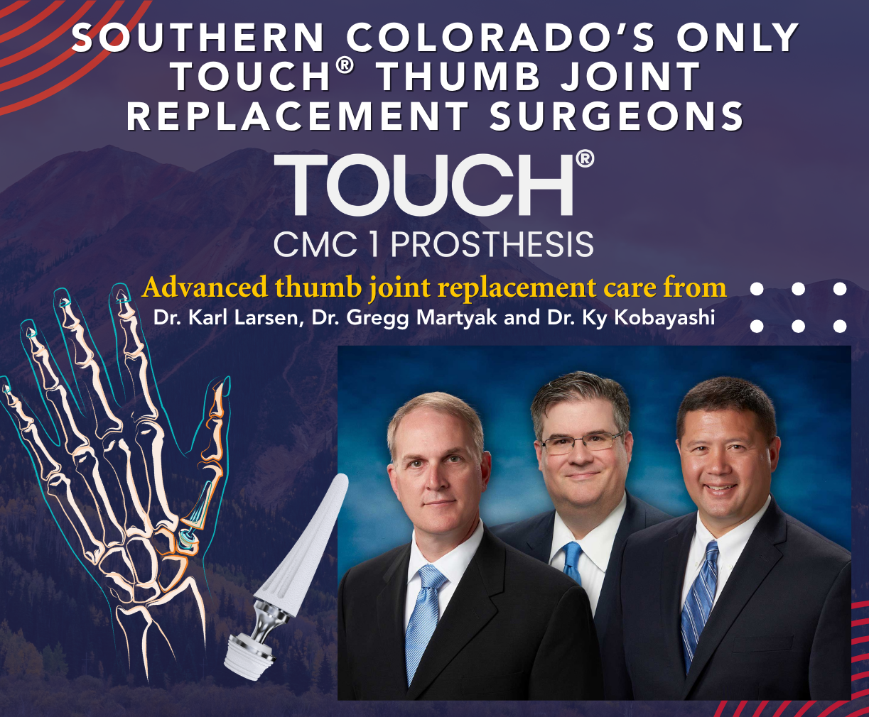 Promotional poster for advanced thumb joint replacement with three doctors and a skeletal hand illustration with a prosthetic implant.