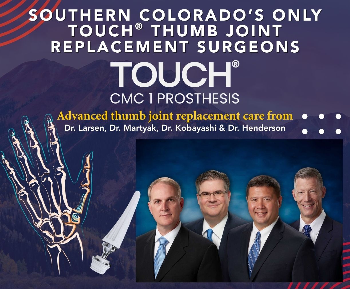 Promotional banner for advanced thumb joint replacement surgeons; features a skeletal hand model, a thumb prosthesis, and a photo of four doctors.