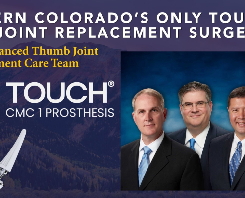Promotional poster for advanced thumb implant and joint replacement with four doctors and a skeletal hand illustration with a prosthetic implant.