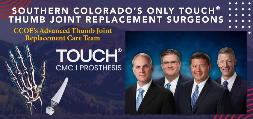 Promotional poster for advanced thumb implant and joint replacement with four doctors and a skeletal hand illustration with a prosthetic implant.